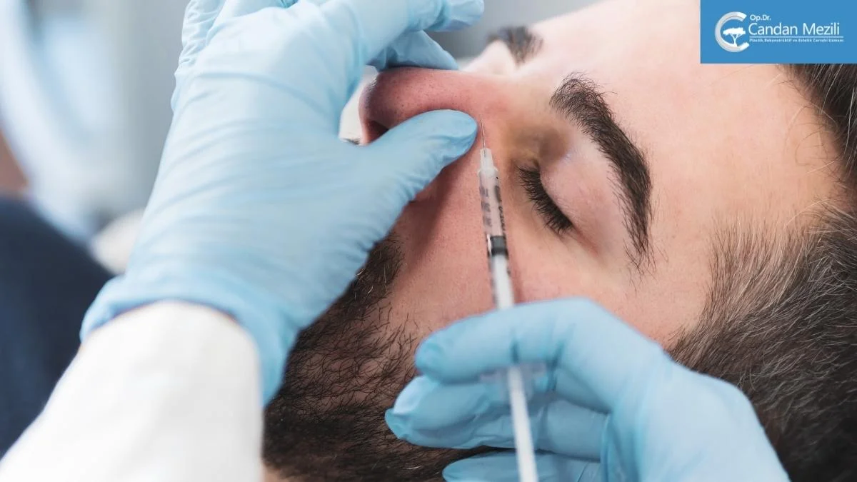 Male Rhinoplasty in Turkey Male Rhinoplasty in Turkey