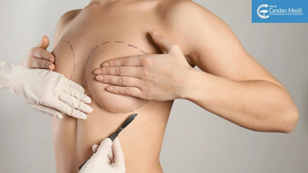 Brustvergrößerung in der Türkei