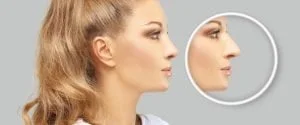 Kalın Derili Burun Estetiği Sanıldığı Kadar Zor mudur? Kalın Derili Burun Estetiği Sanıldığı Kadar Zor mudur?