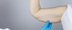 Wie viel kostet eine Armstraffung in Deutschland? Wie viel kostet eine Armstraffung in Deutschland?