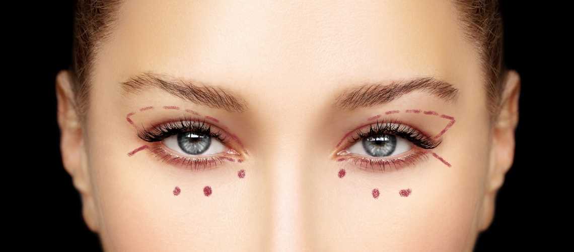 How Much Does Blepharoplasty Cost in UK? How Much Does Blepharoplasty Cost in UK?