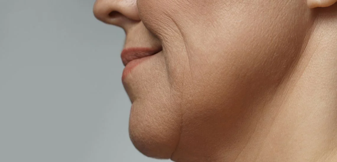 Jawline Dolgusu Fiyatları Jawline Dolgusu Fiyatları