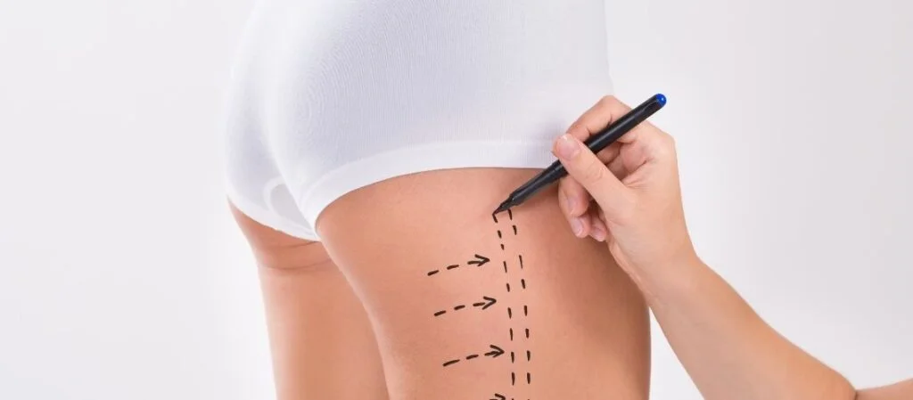 Lipomatik Fiyatları Lipomatik Fiyatları 2022