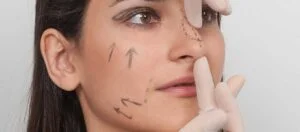 Is Nasal Tip Plasty Right for You? Is Nasal Tip Plasty Right for You?