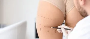 Buttocks Liposuction in Turkey Buttocks Liposuction in Turkey