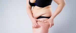 Thigh Liposuction in Turkey Thigh Liposuction in Turkey